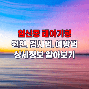 태아기형검사방법에대한포스팅의섬네일